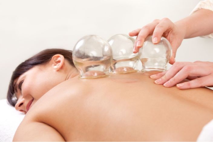 Cupping Therapy
